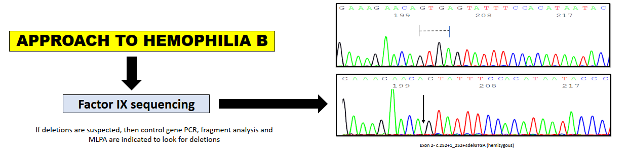 Approach to Hemophilia B